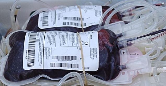 SANITA': TRASFUSIONI, A OSPEDALE AVEZZANO PROTOCOLLO PBM
